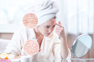 peau sèche et déshydratée